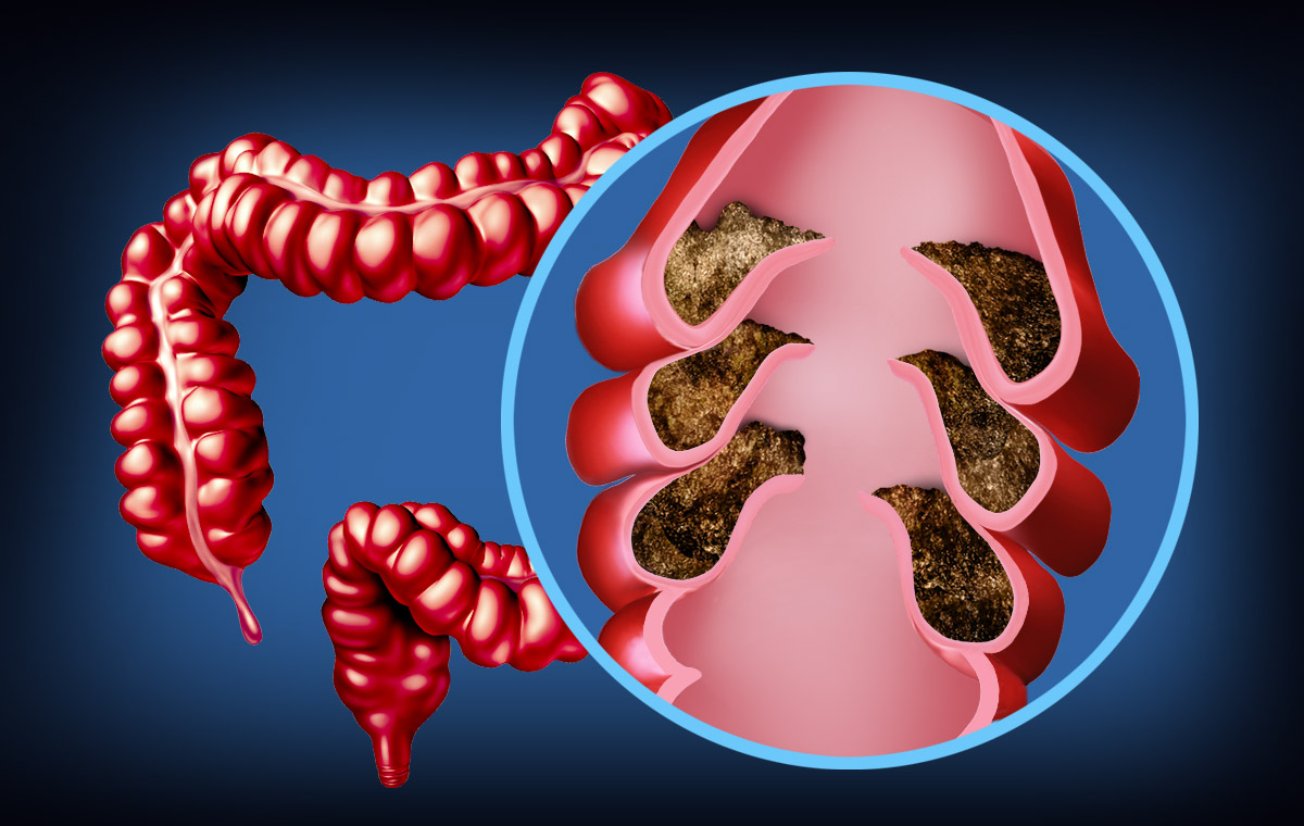 Intestino Normal Como restabelecer o funcionamento normal do intestino?